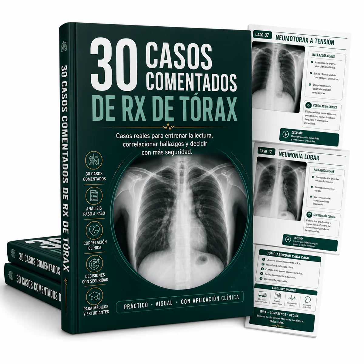 30 casos comentados