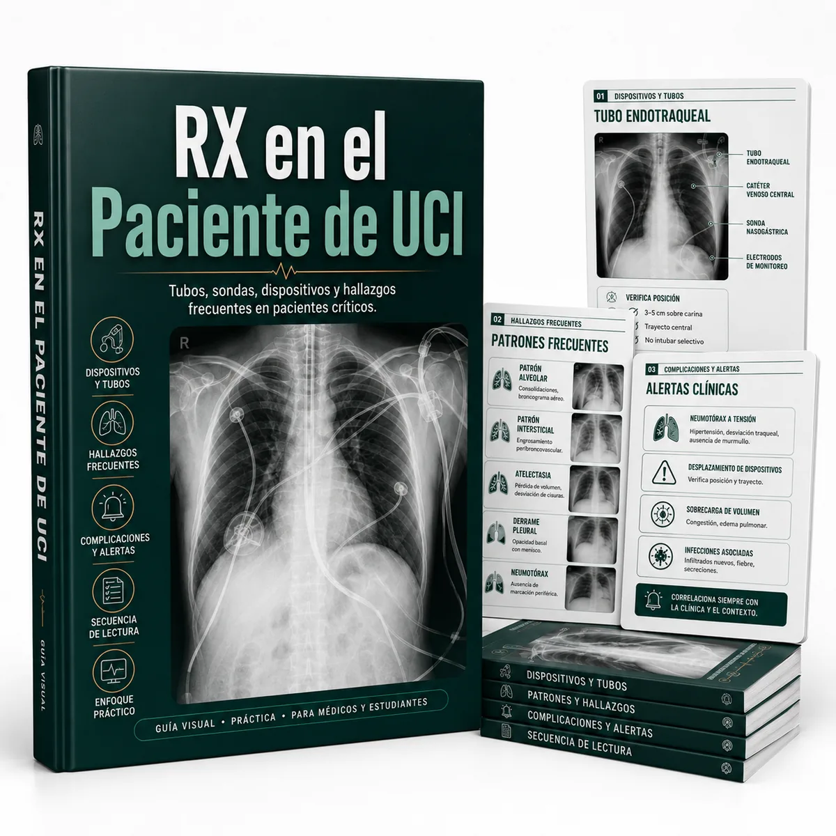 RX en paciente de UCI