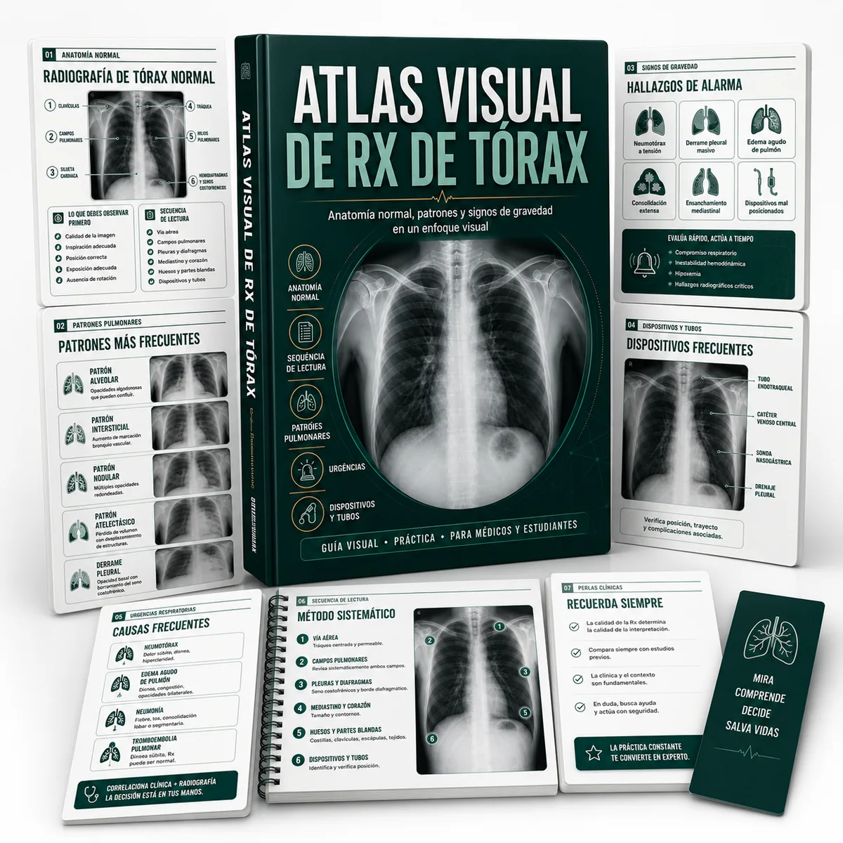 Atlas Visual de RX de Tórax
