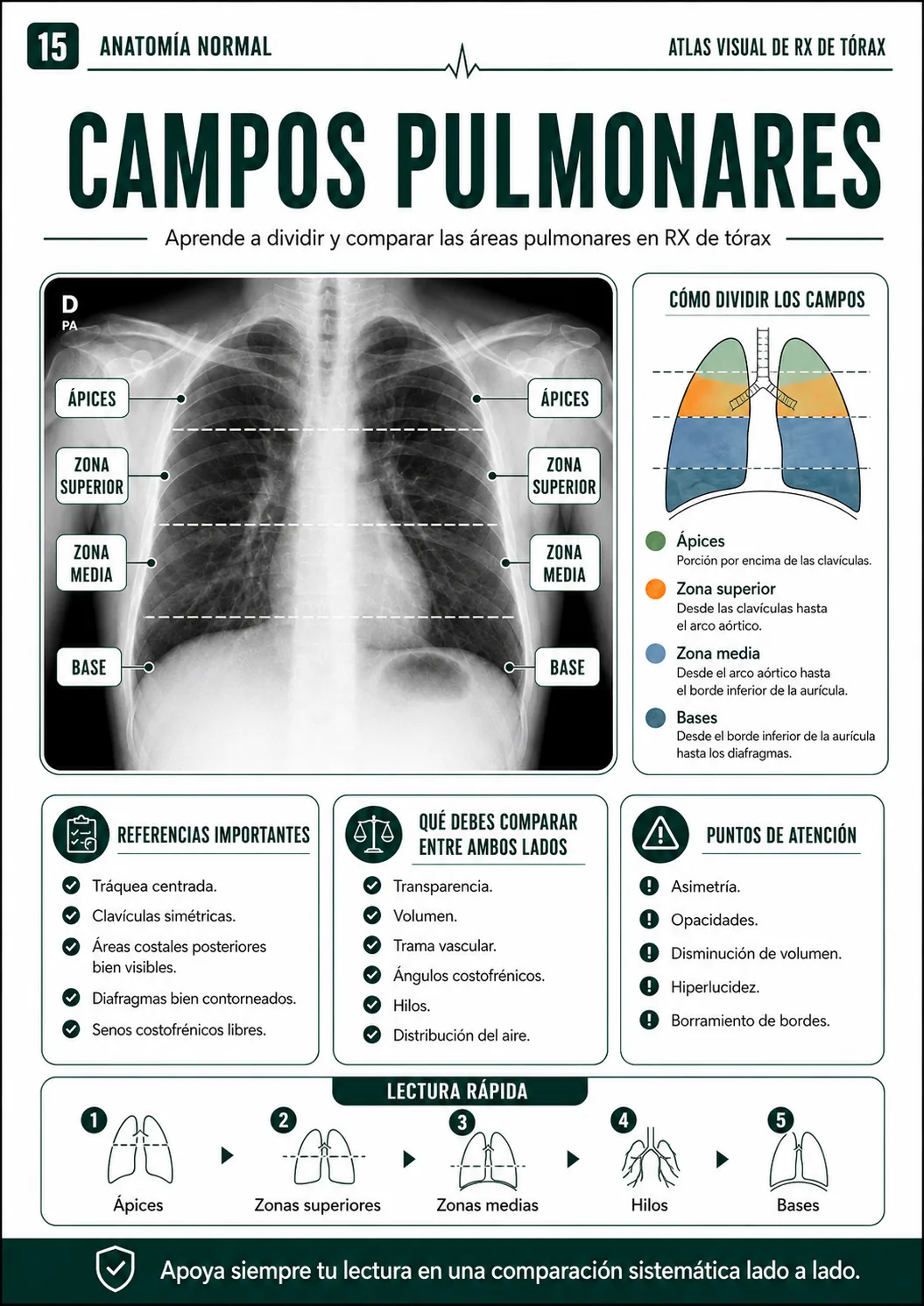 Campos pulmonares