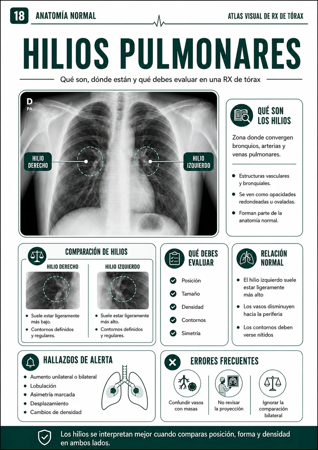 Hilios pulmonares